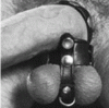Ball Stretcher and Divider with Cock Ring